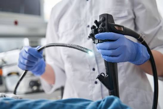 Endoscopía